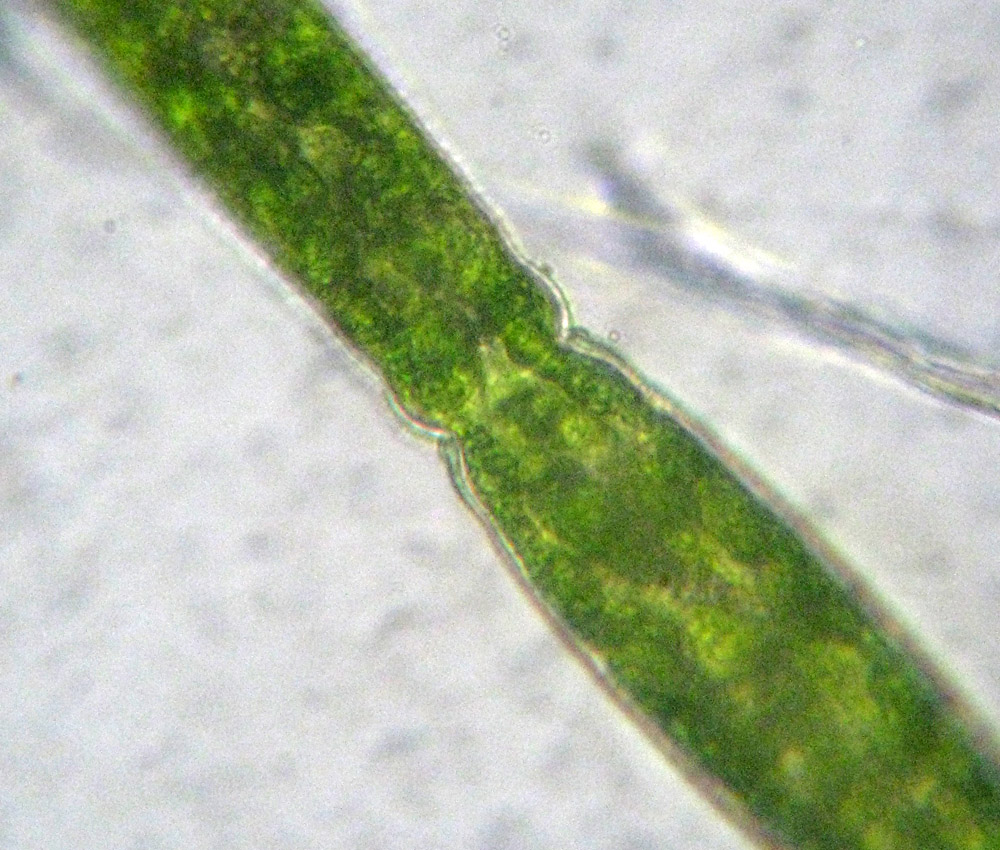 Pleurotaenium sp.